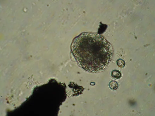 Secondo campione biologico osservato al microscopio
